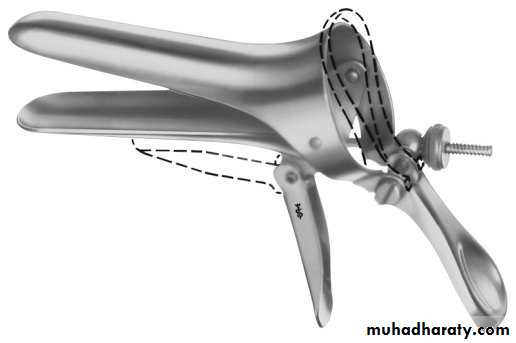History and examination in Gynecology