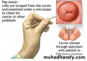 History and examination in Gynecology