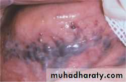 History and examination in Gynecology