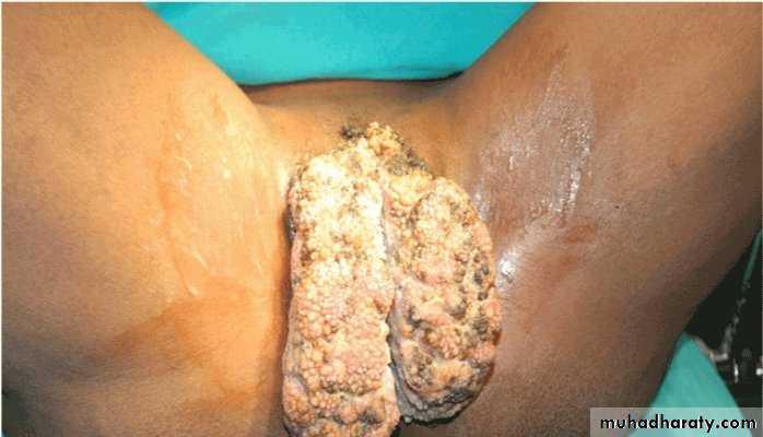 History and examination in Gynecology