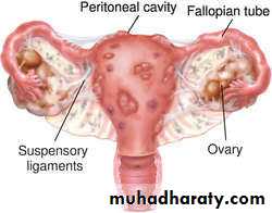 History and examination in Gynecology