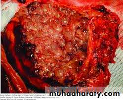 History and examination in Gynecology