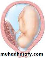 History and examination in Gynecology