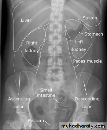 HOW TO READ AN ABDOMINAL X-RAY