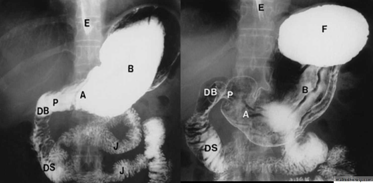 HOW TO READ AN ABDOMINAL X-RAY