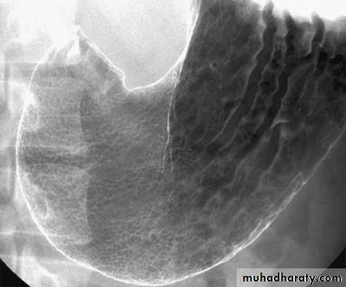 HOW TO READ AN ABDOMINAL X-RAY