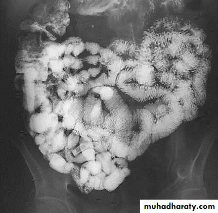 HOW TO READ AN ABDOMINAL X-RAY