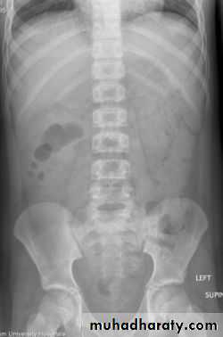 HOW TO READ AN ABDOMINAL X-RAY