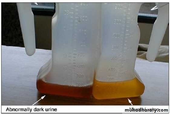 jaundice