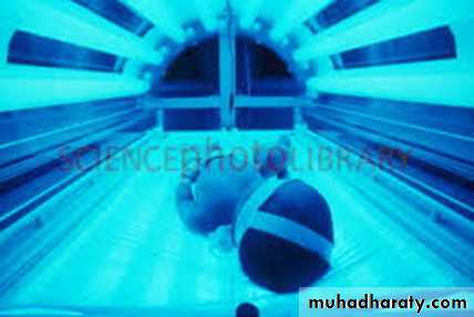 jaundice
