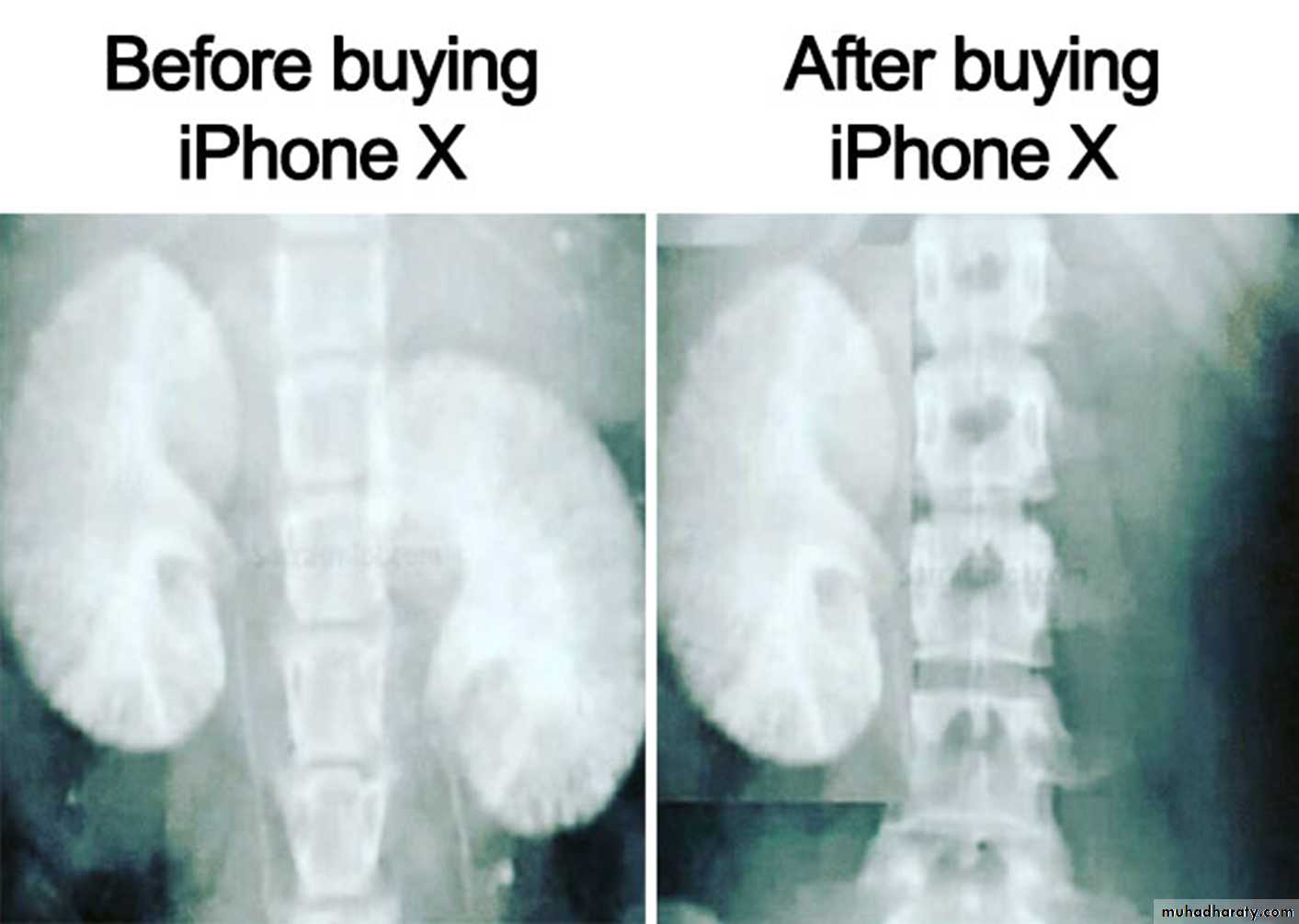 Kidney