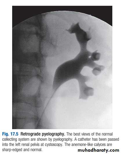 Kidney