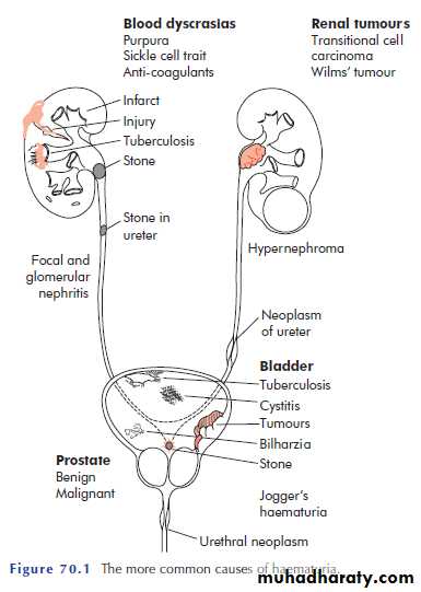 Urology