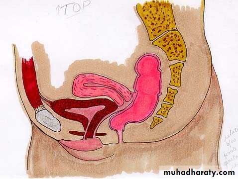 Urology