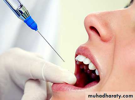 local anesthesia