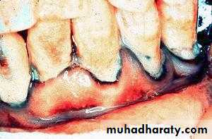 Toxicology management