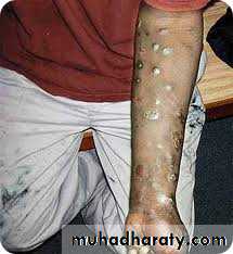 Toxicology management