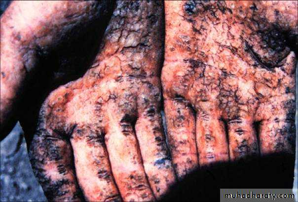 Toxicology management