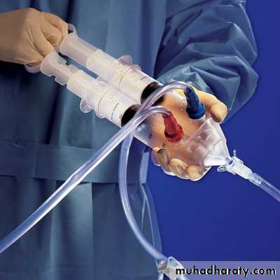 Toxicology management