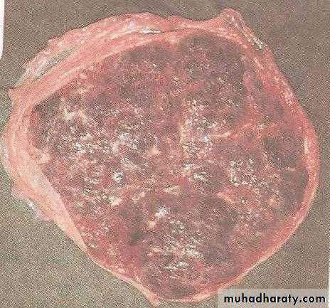 The placenta