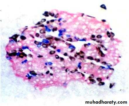 Glands عملي