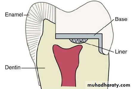 Treatment of deep seated caries