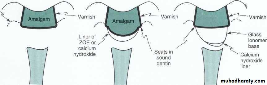 Treatment of deep seated caries
