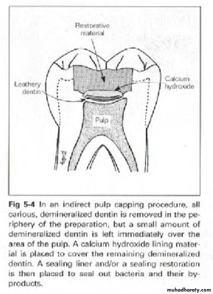 Treatment of deep seated caries