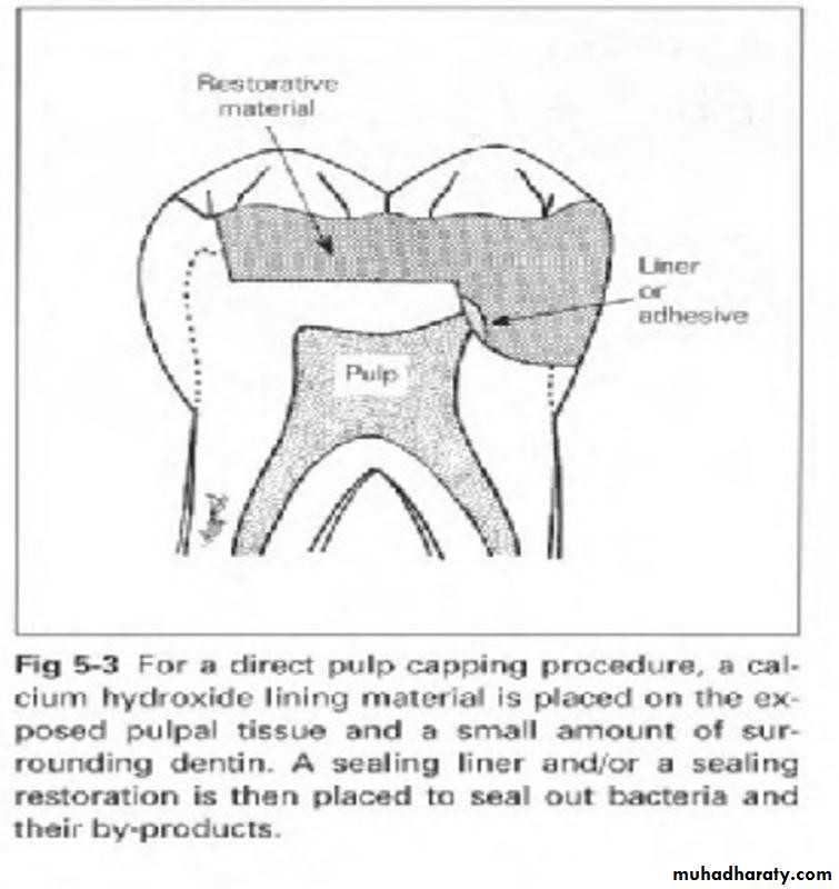 Treatment of deep seated caries
