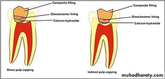 Treatment of deep seated caries