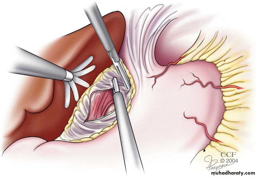 Esophagus