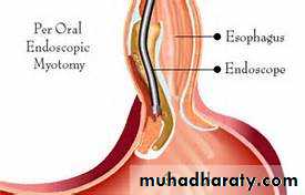 Esophagus