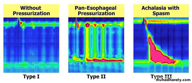 Esophagus