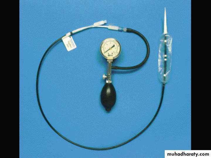 Esophagus
