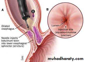 Esophagus