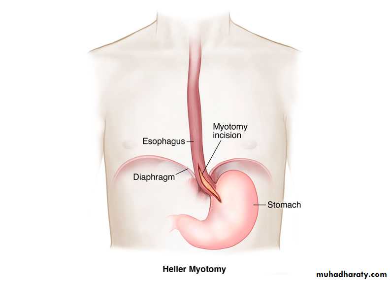 Esophagus