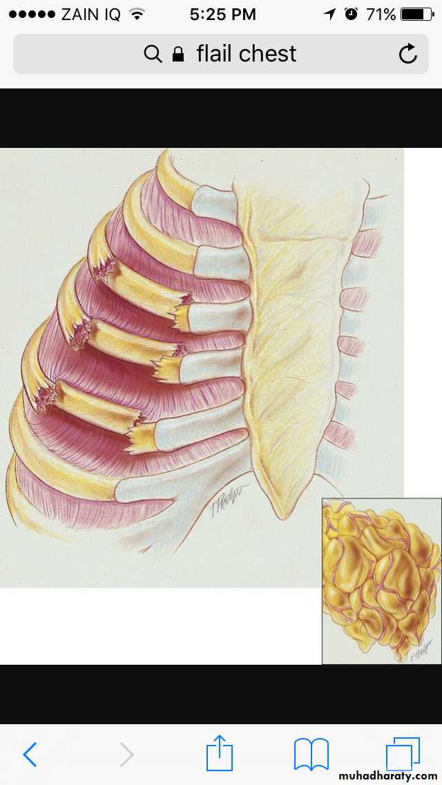 Chest investigations