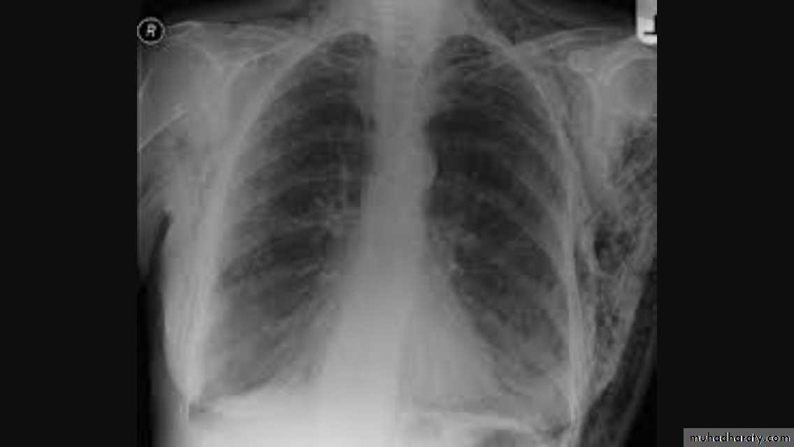 Chest investigations