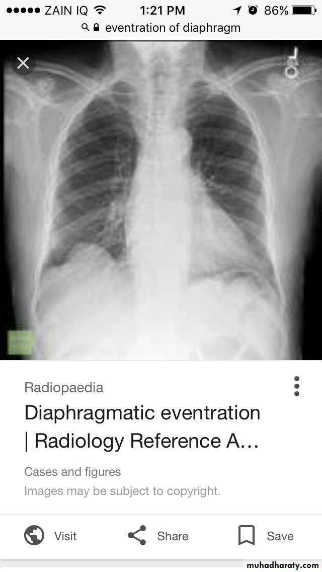 Chest investigations