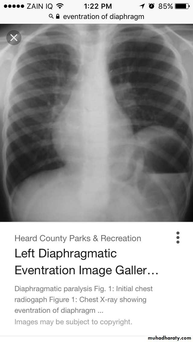 Chest investigations