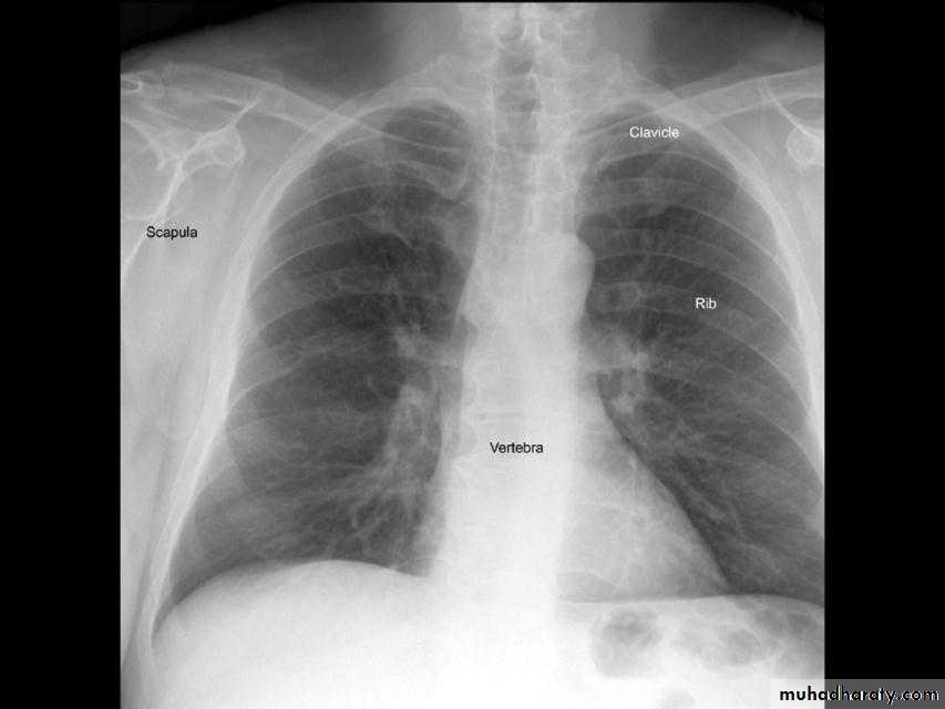 Chest investigations