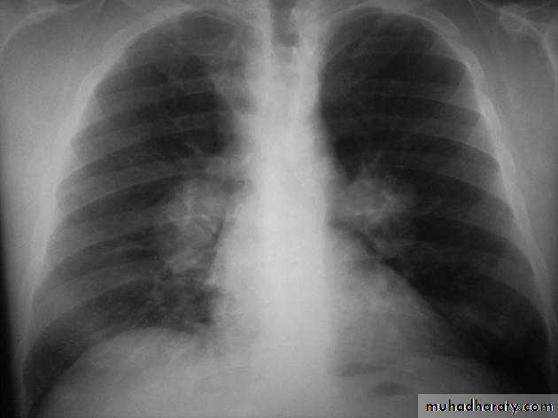 Chest investigations