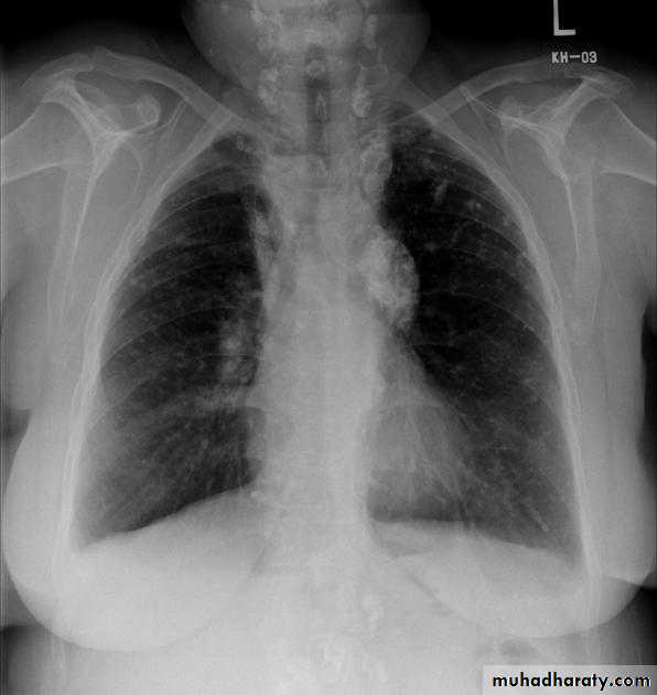 Chest investigations