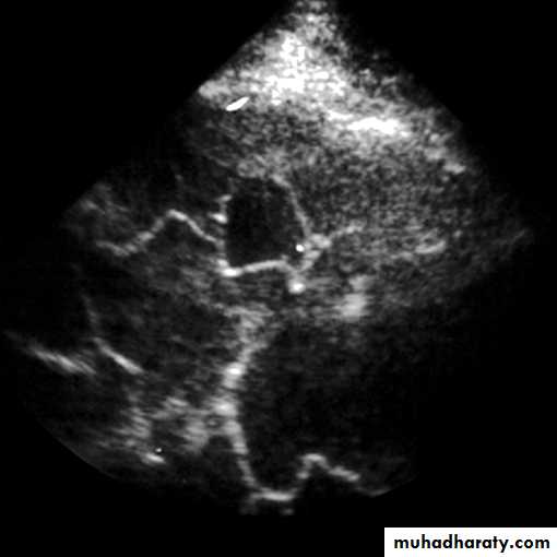 Chest investigations