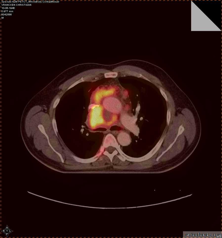 Chest investigations