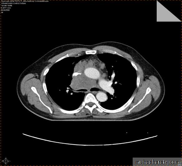 Chest investigations