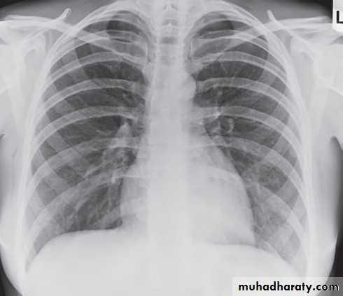 Chest investigations