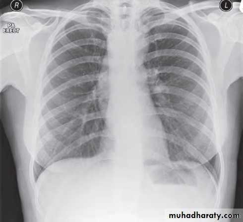 Chest investigations