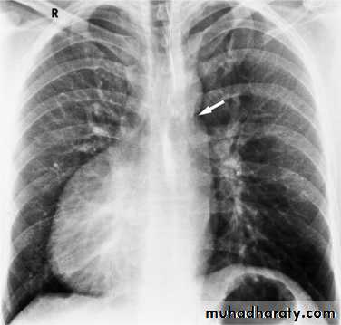 Chest investigations