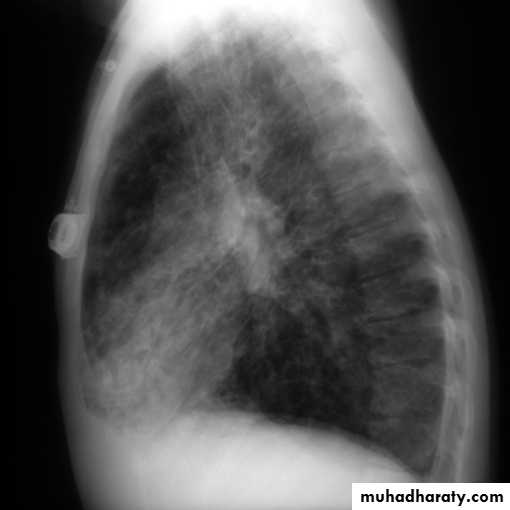 Chest investigations